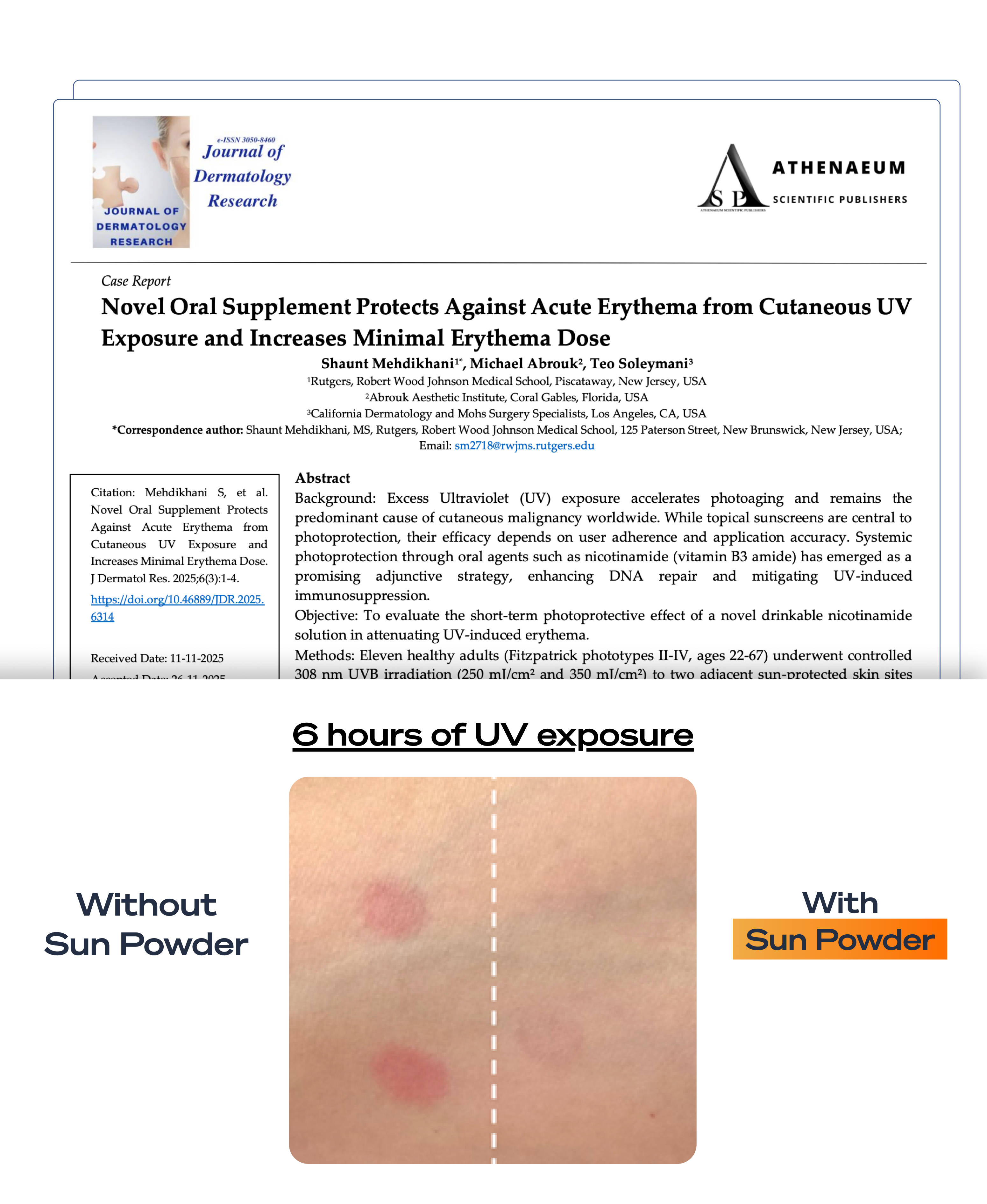 Journal of Dermatology Research — Sun Powder clinical trial results showing UV redness with and without Sun Powder